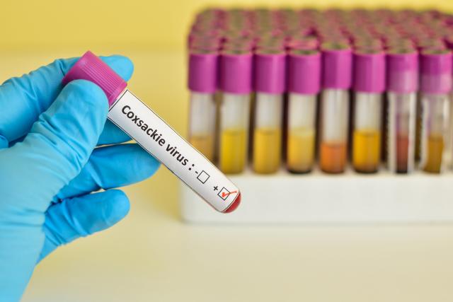 Kada je imunitet slab, koksaki napada srce